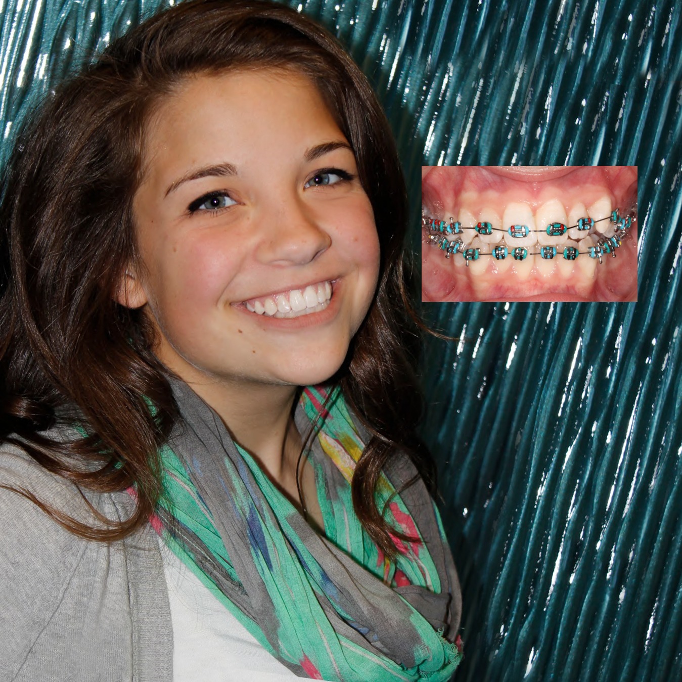 Salem Braces
