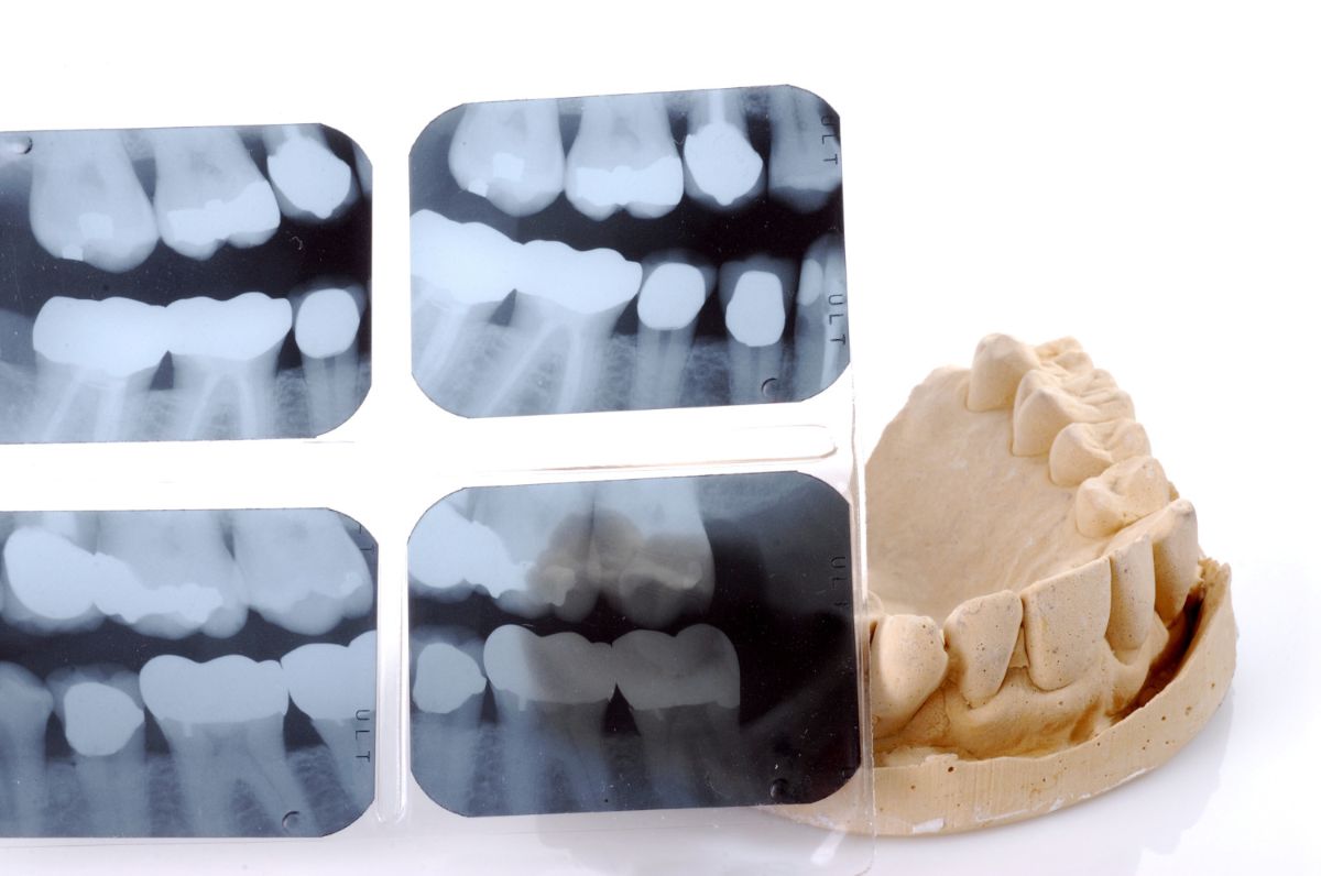 Can Orthodontics Fix Facial Asymmetry?
