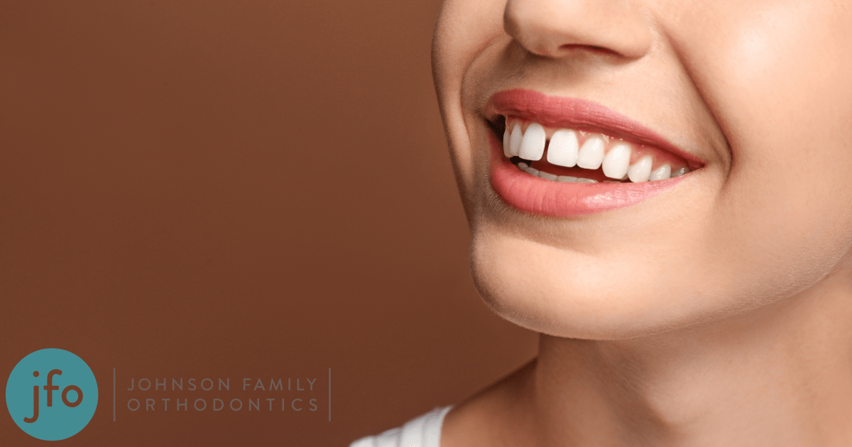 TikTok Users Are Closing Teeth Gaps Using Rubber Bands: Here’s Why You Shouldn't Do It