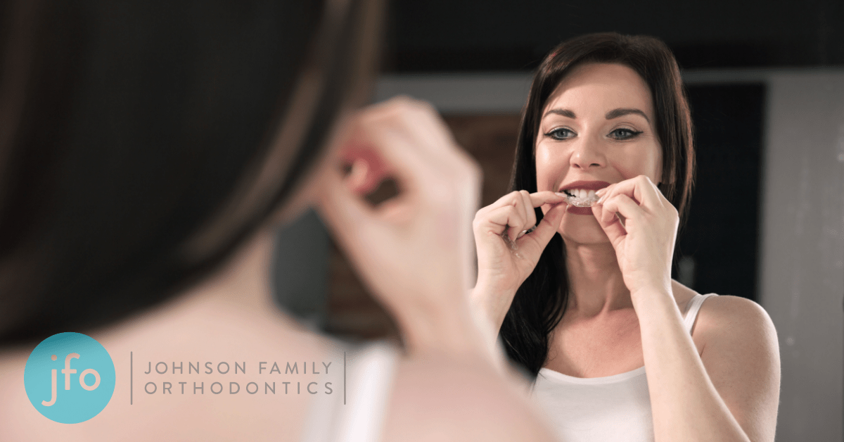 Living With Invisalign: The Ultimate Guide to Maintaining Your Aligners