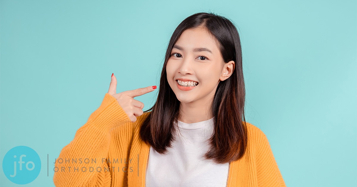 Retainers: Why They Matter More Than You Think