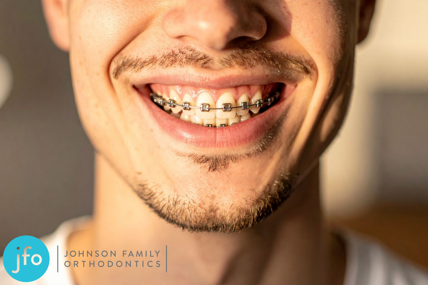 Braces Survival Guide: What to Eat, How to Manage Pain, and Broken Bracket Fixes