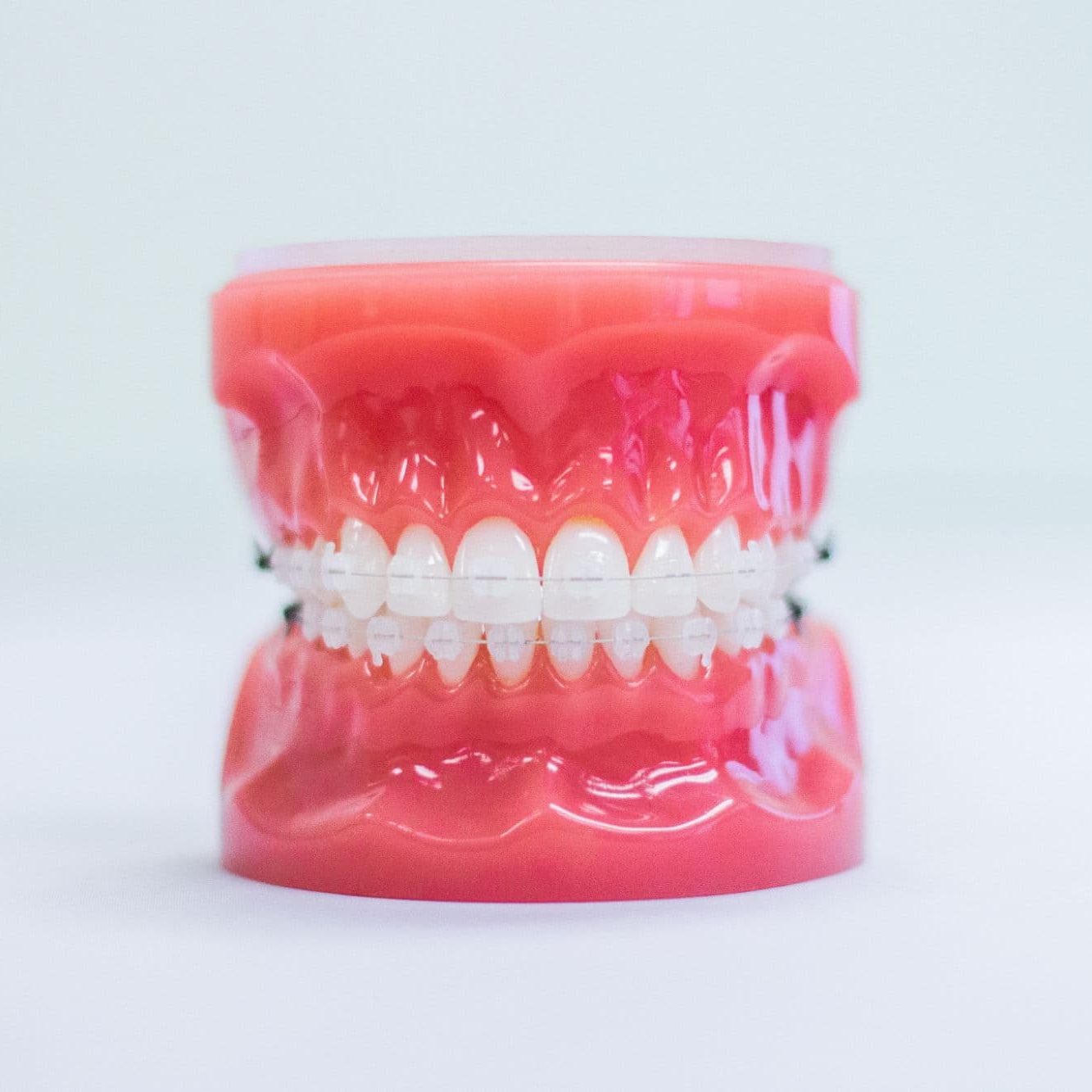 Brackets transparentes