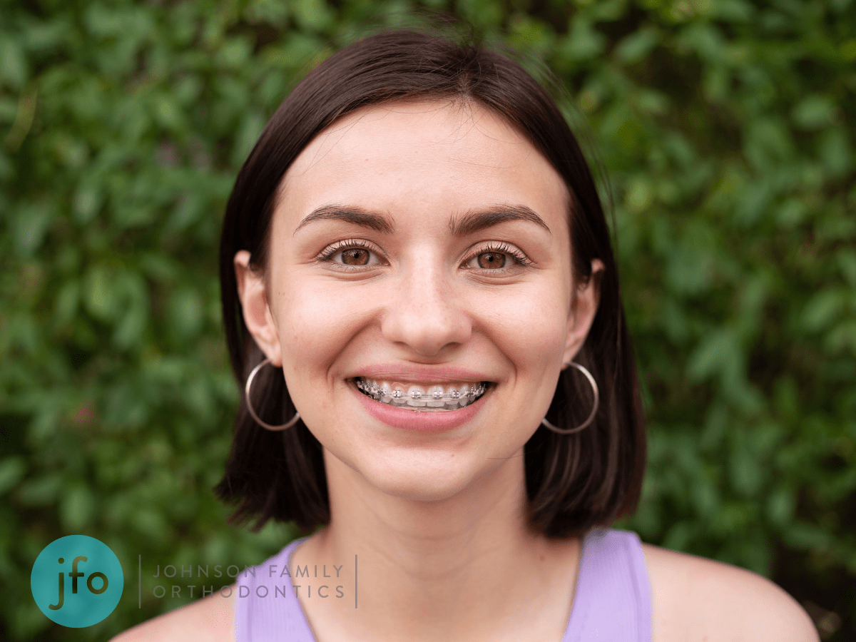 Girl with braces in front of greenary