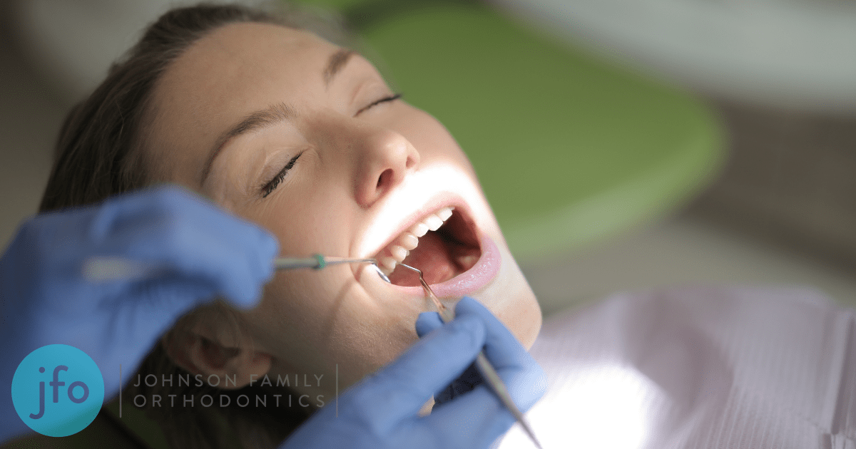 Dentist checking teeth