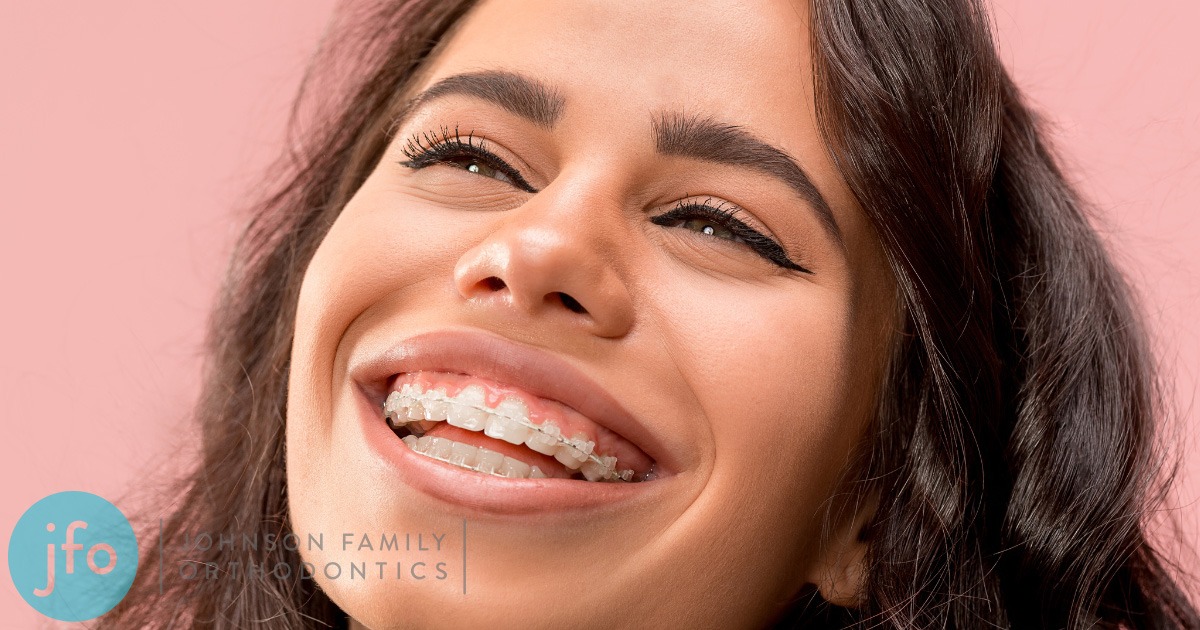 Happy Girl Post Braces