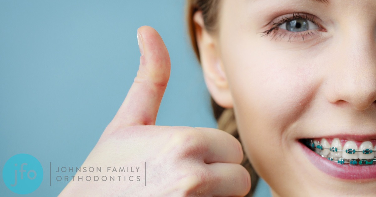 Young lady with braces and thumbs up