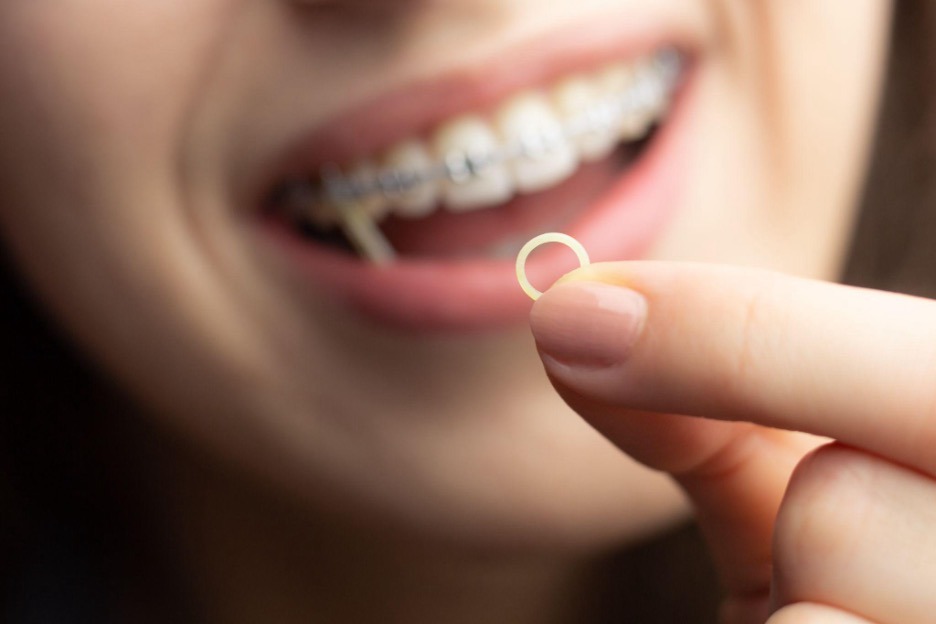 Girl removing rubber bands.