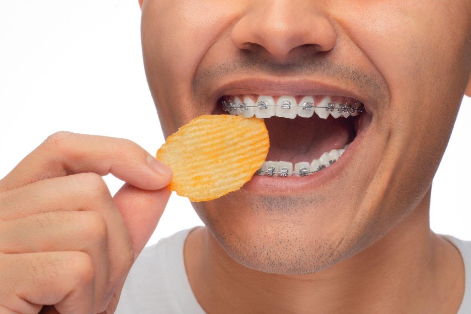 Teen eating chip with braces
